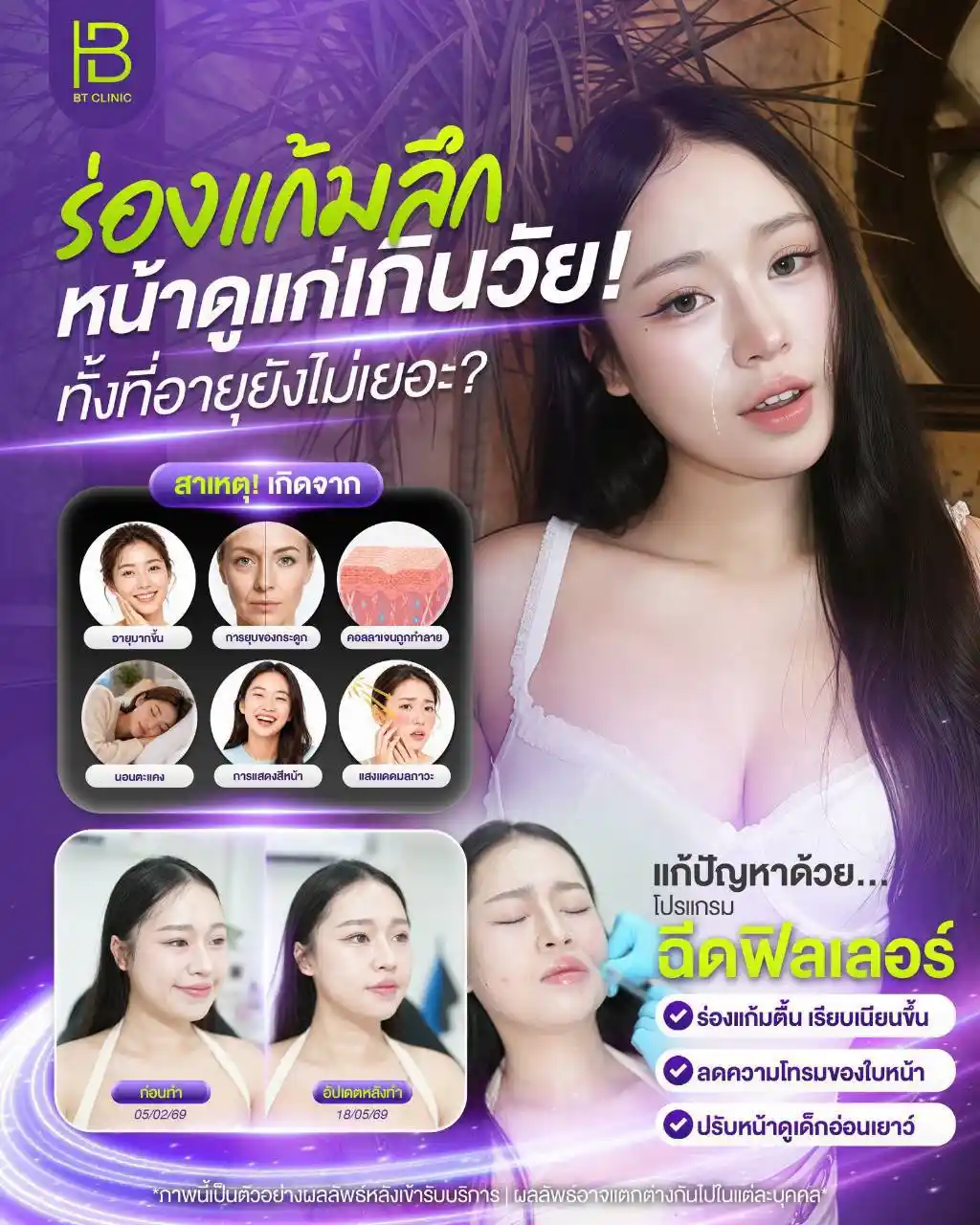 รูปรีวิว 102