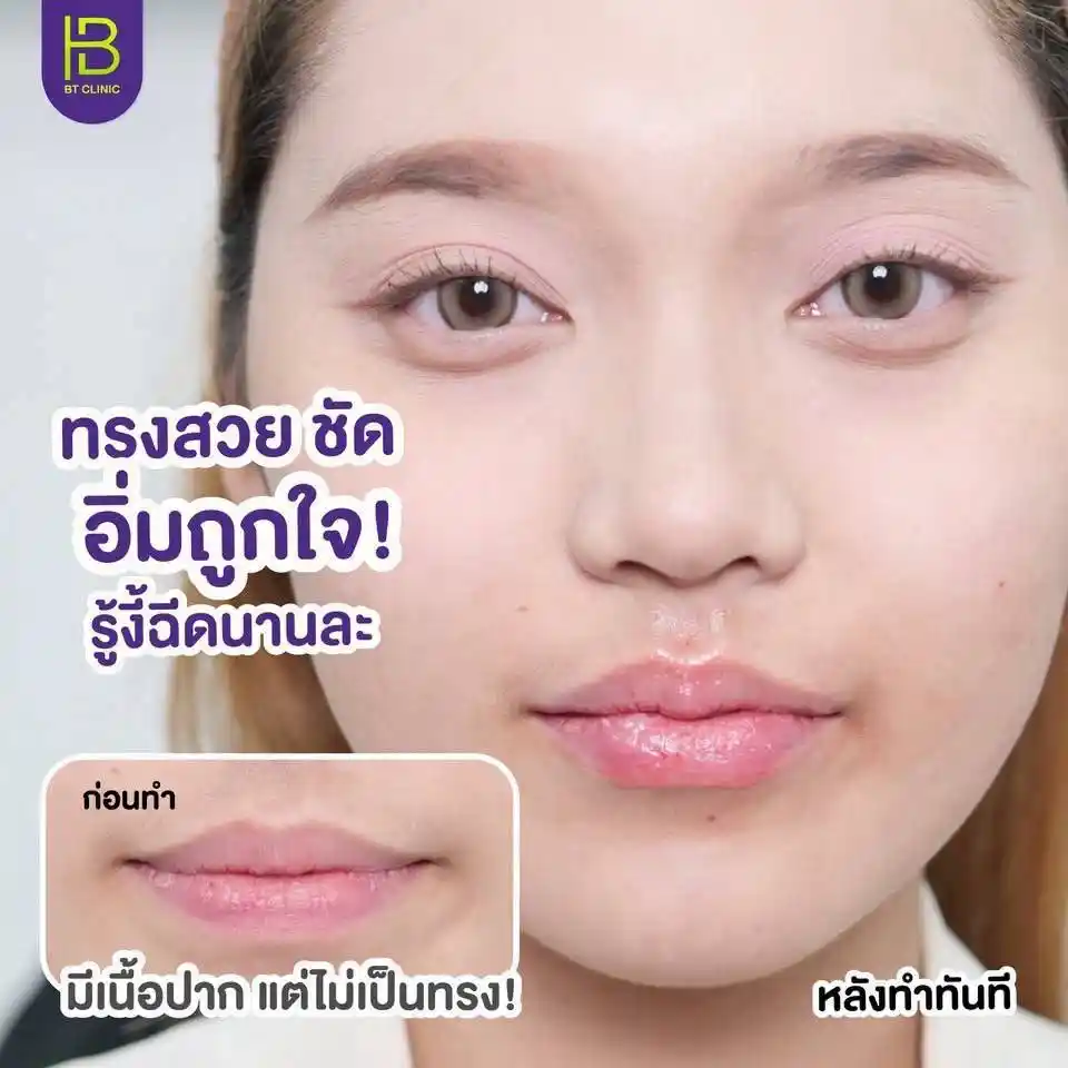 รูปรีวิว 103
