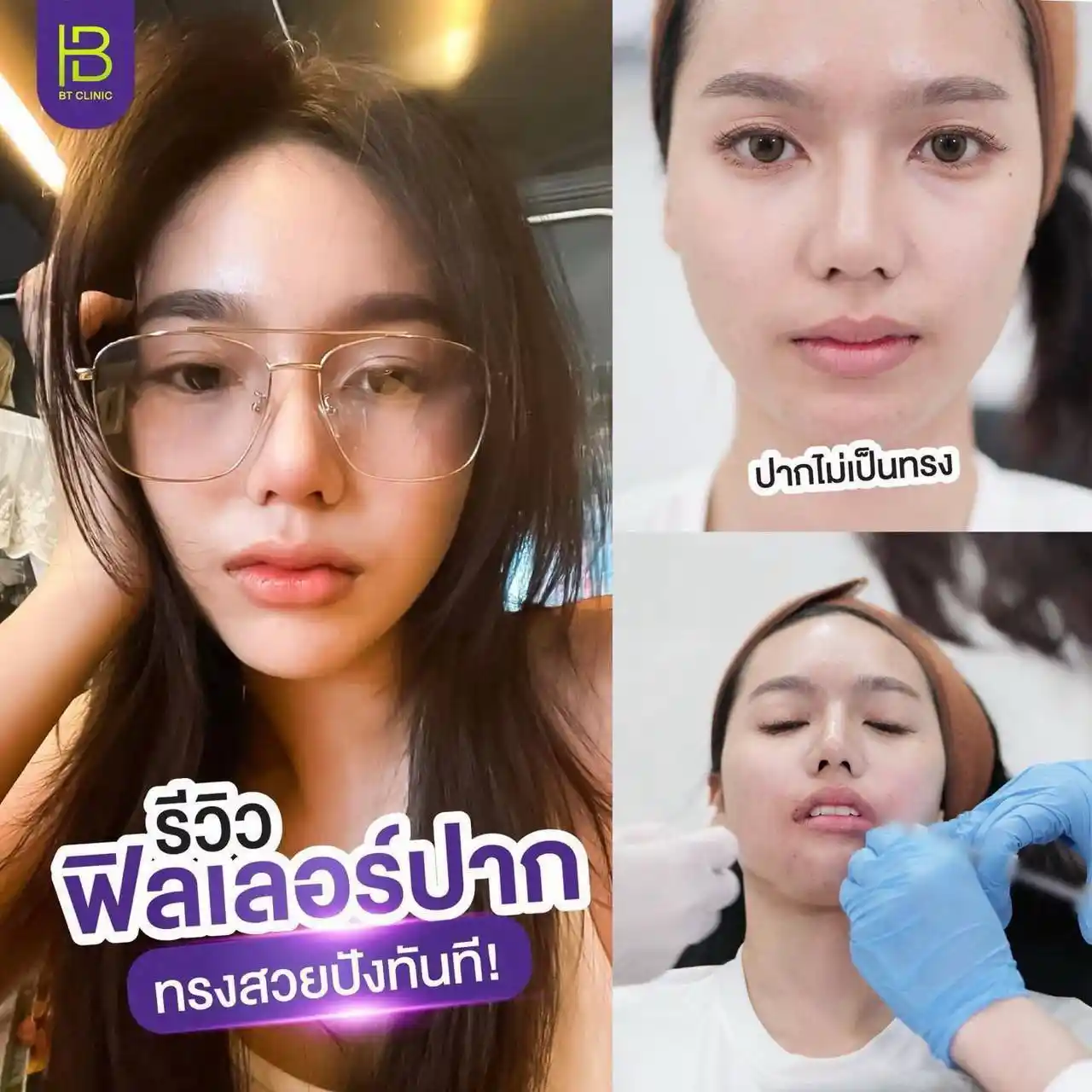 รูปรีวิว 104