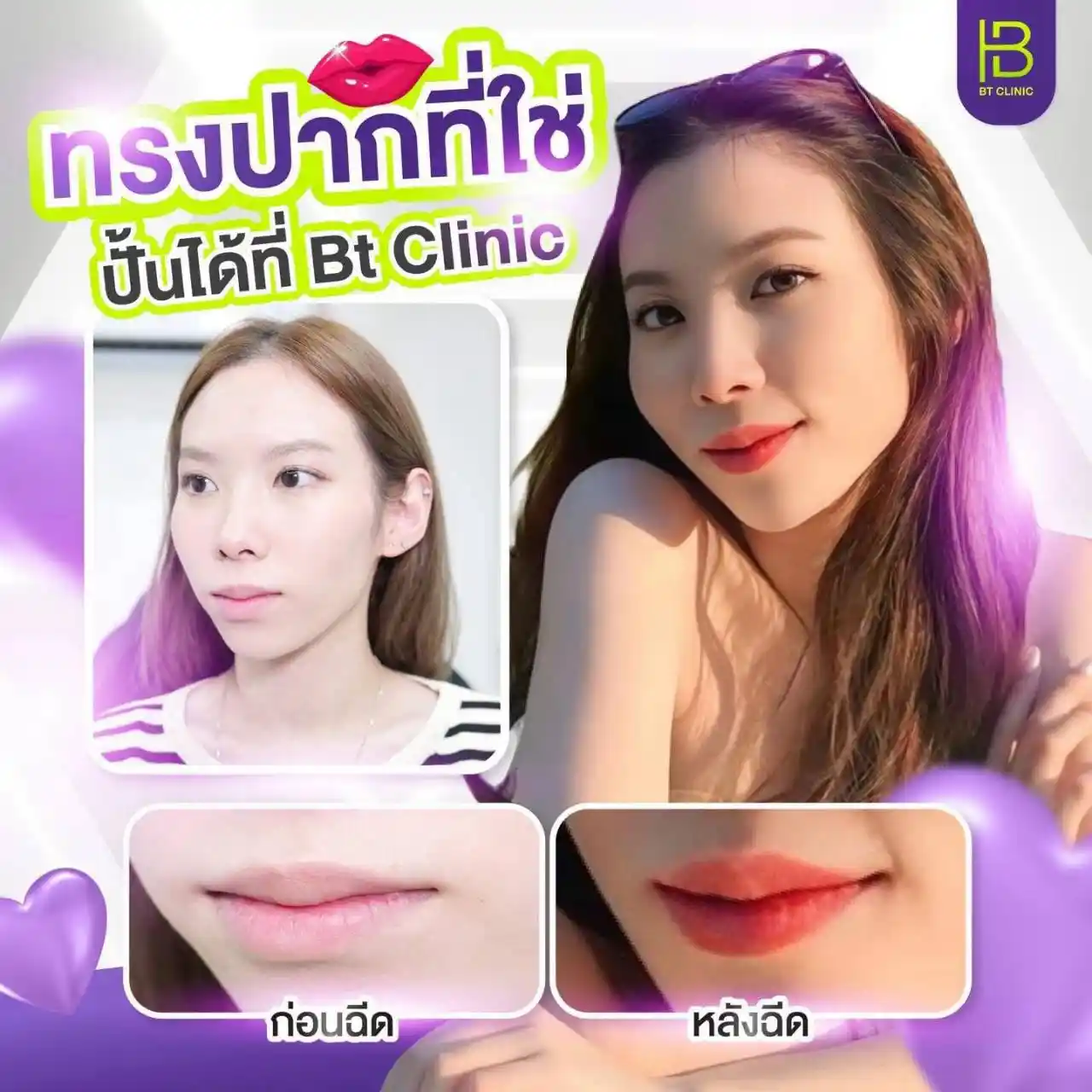รูปรีวิว 106