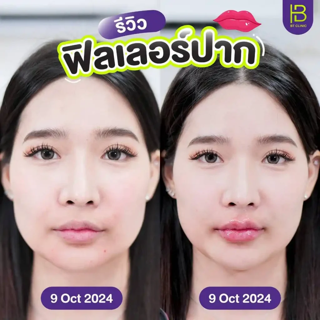 รูปรีวิว 109