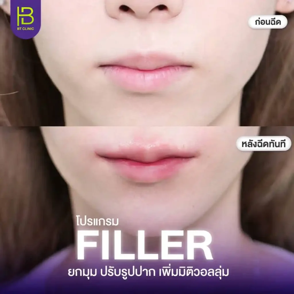 รูปรีวิว 110