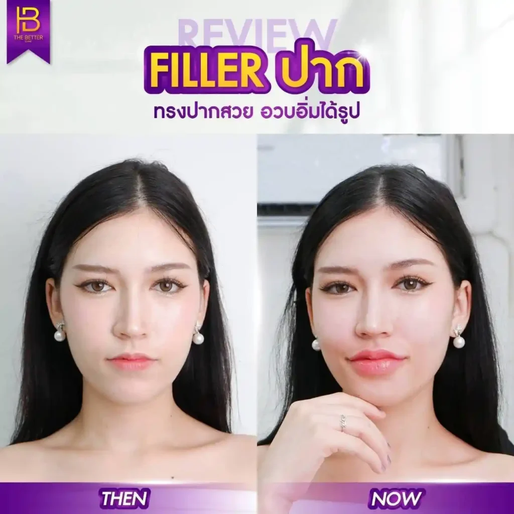 รูปรีวิว 112