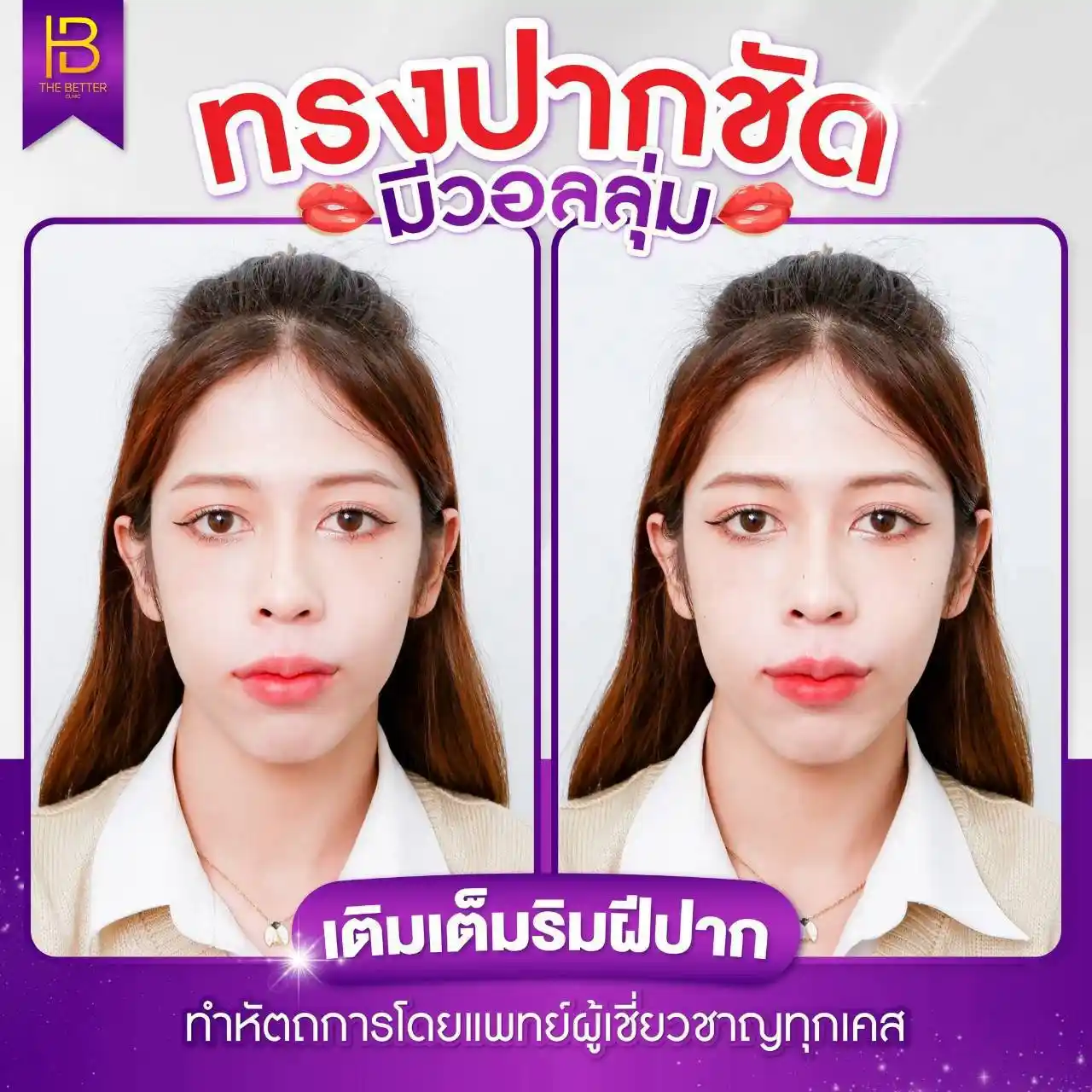 รูปรีวิว 115