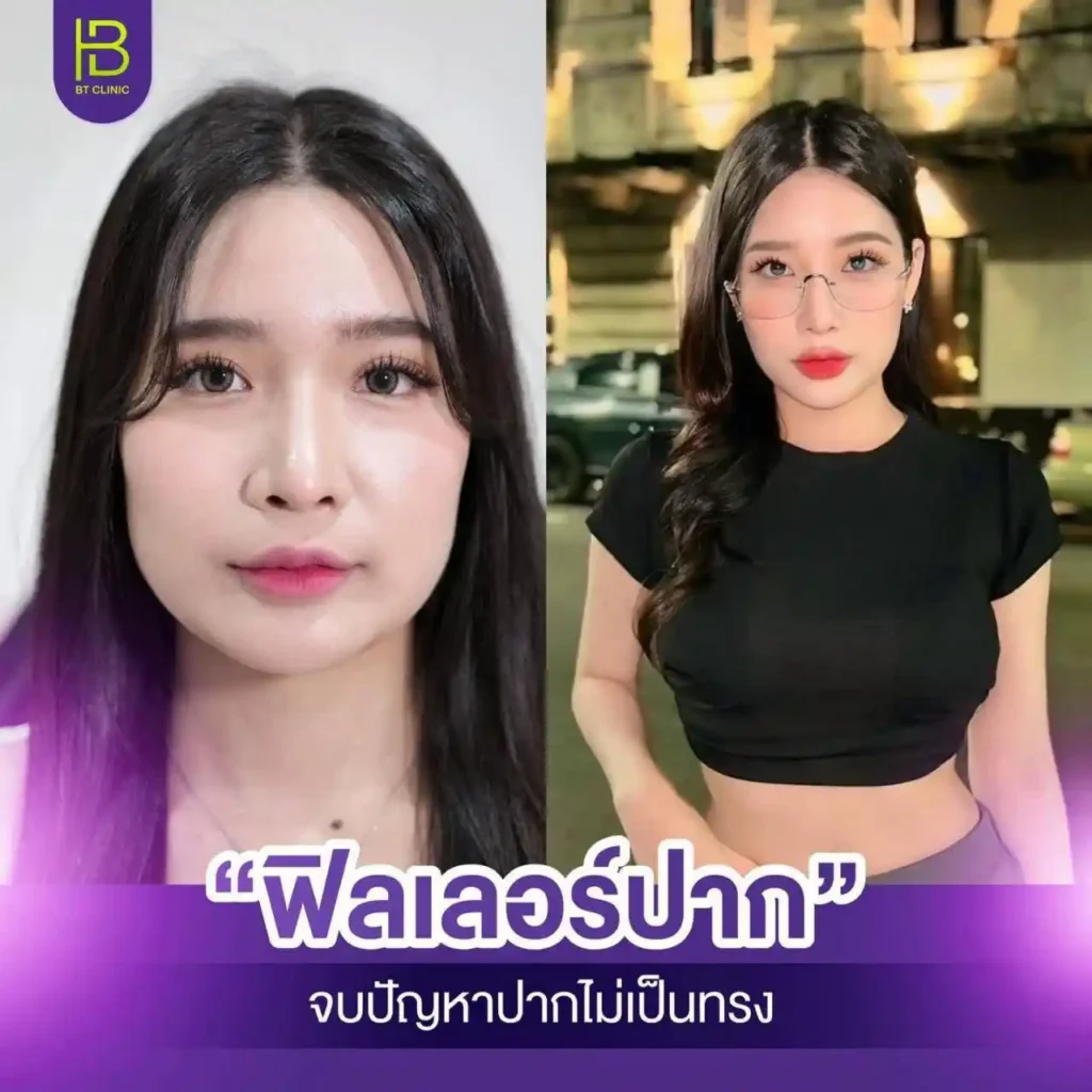 รูปรีวิว 116