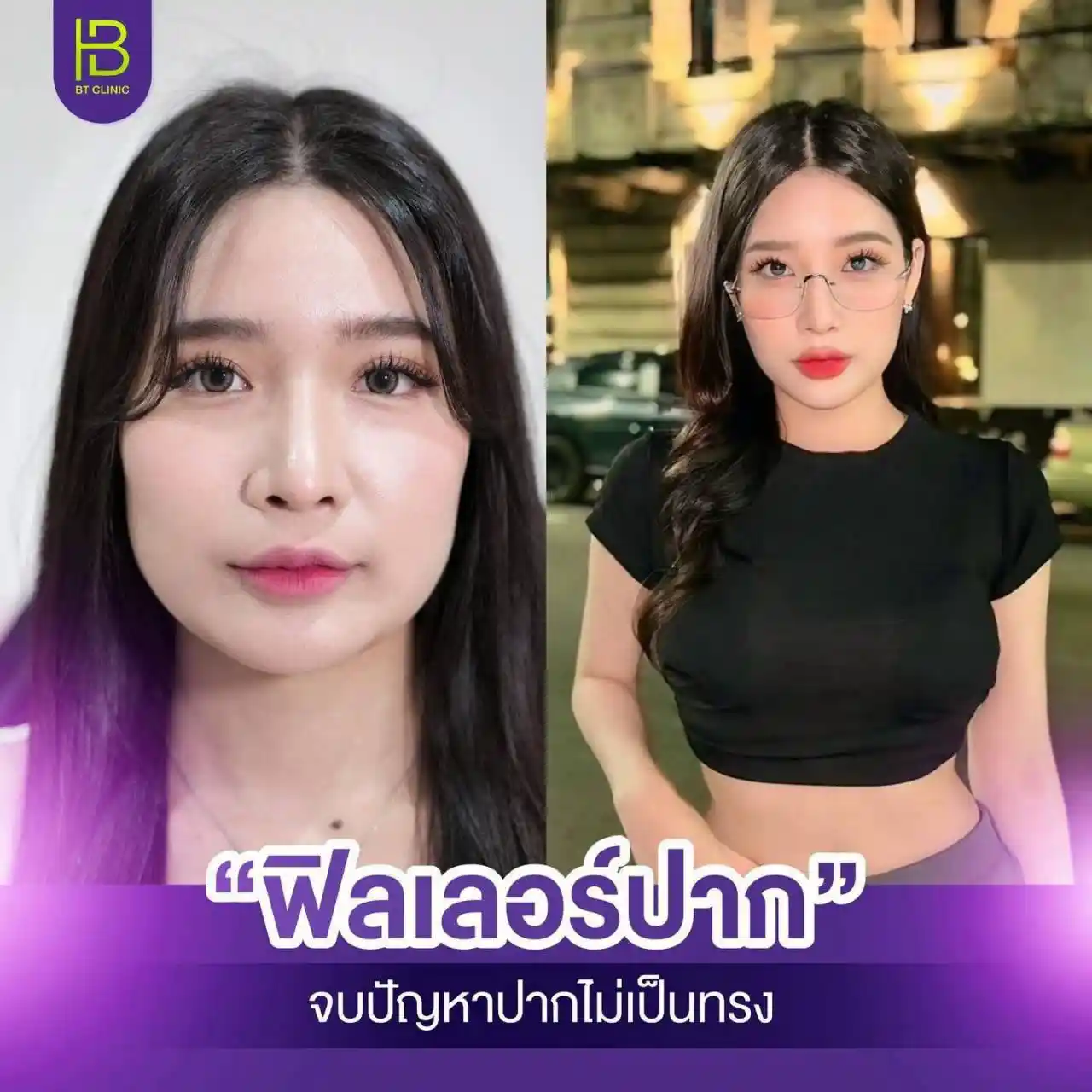 รูปรีวิว 116