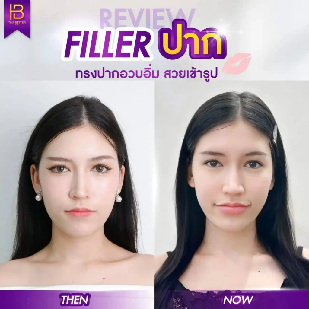 รูปรีวิว 118