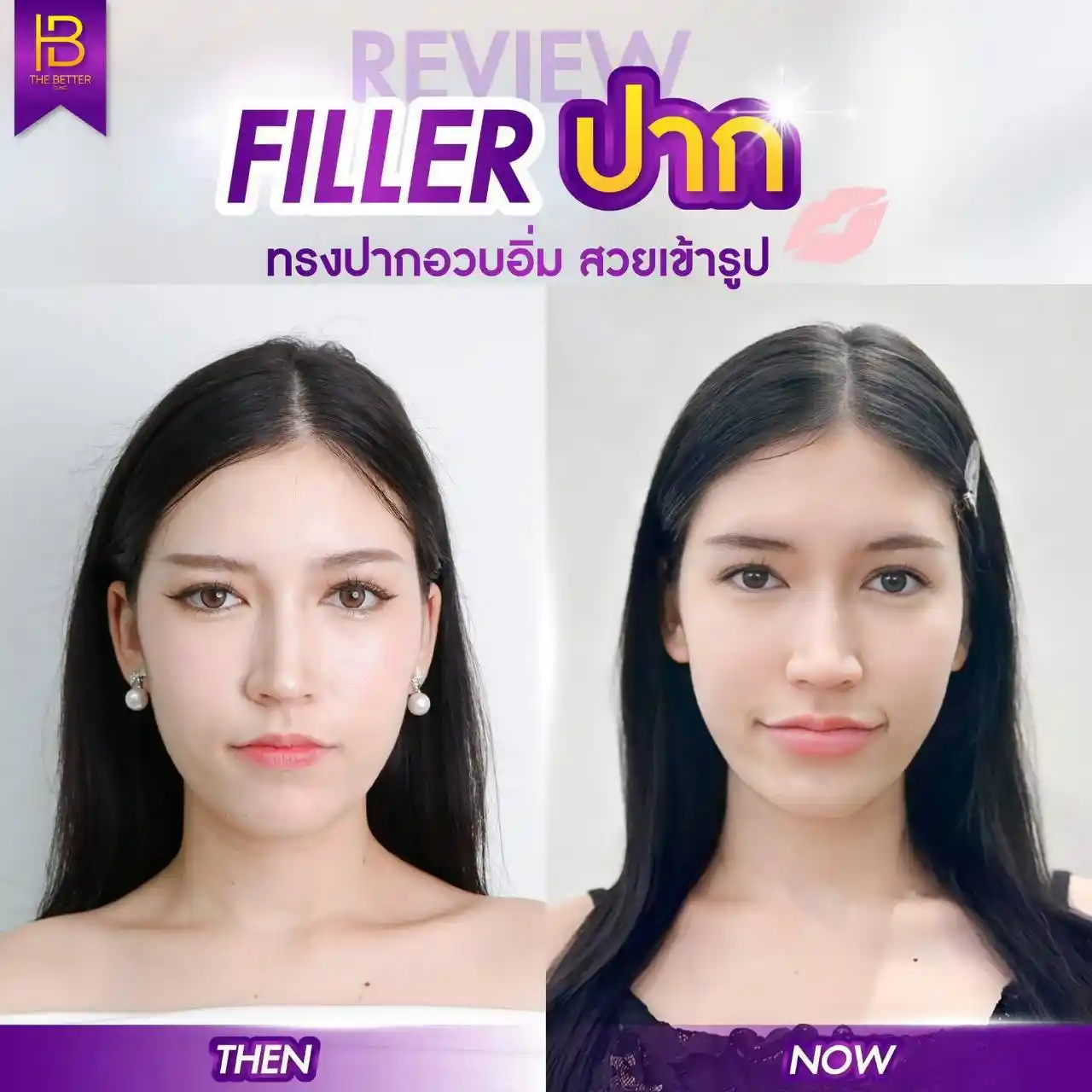 รูปรีวิว 118