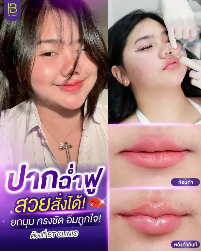 รูปรีวิว 120