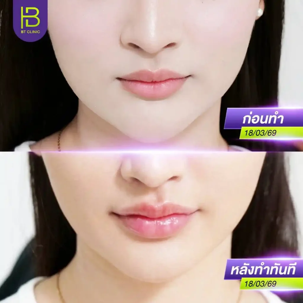 รูปรีวิว 124