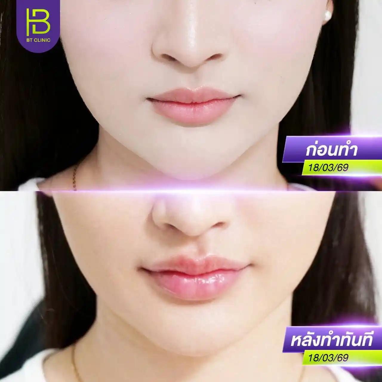 รูปรีวิว 124