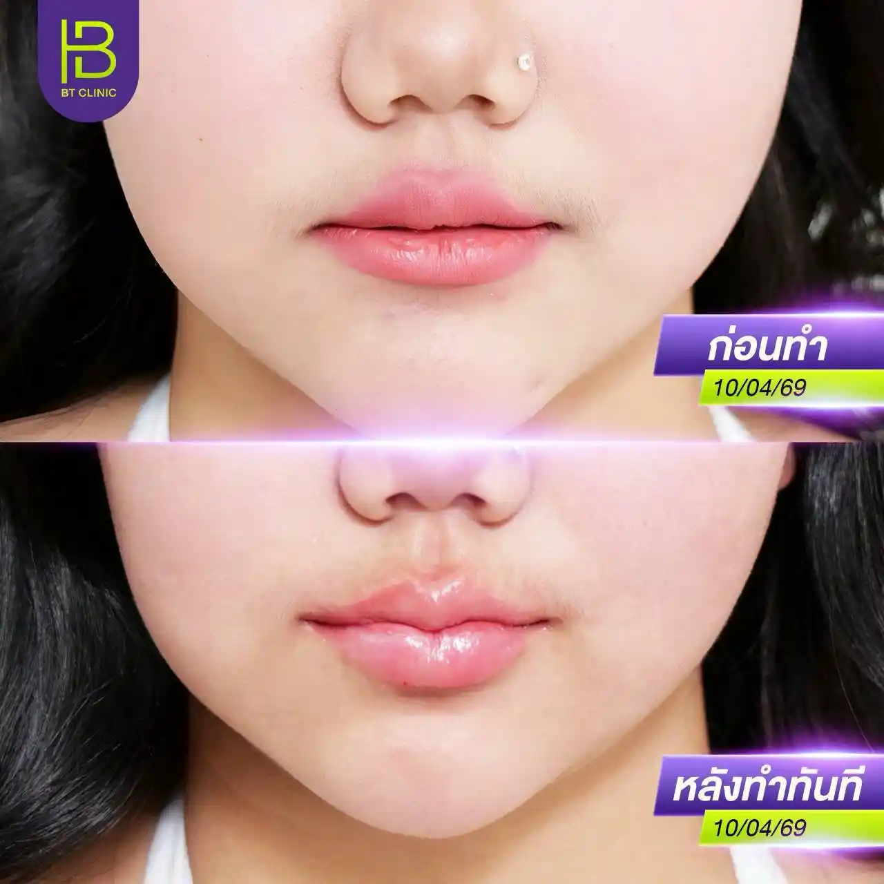 รูปรีวิว 125