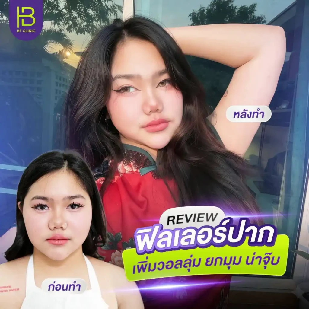 รูปรีวิว 126
