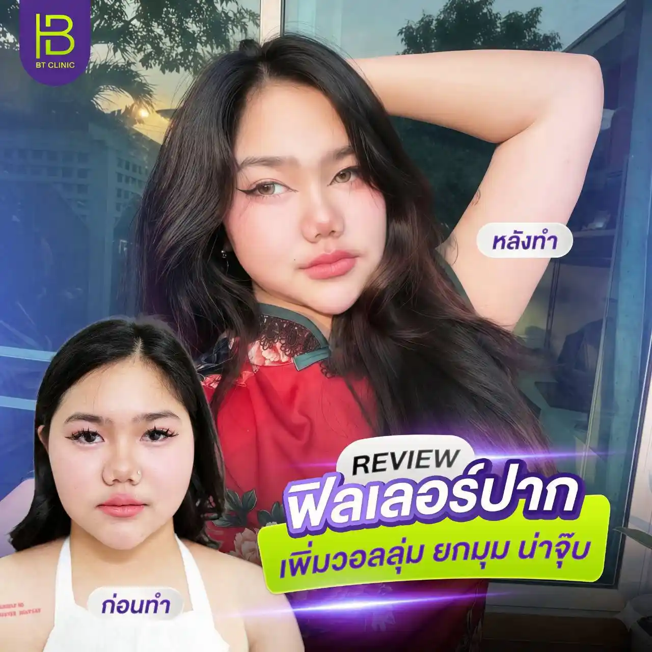 รูปรีวิว 126