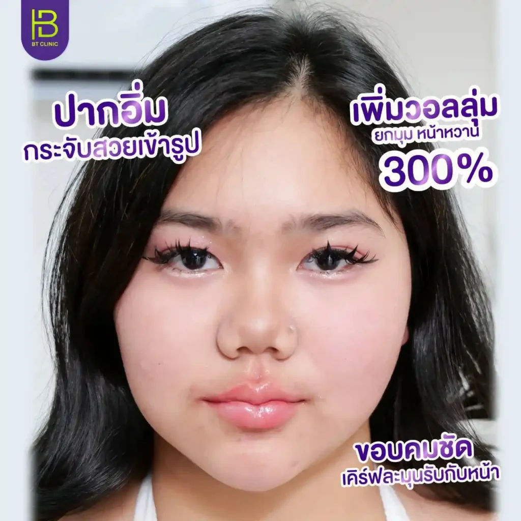 รูปรีวิว 127