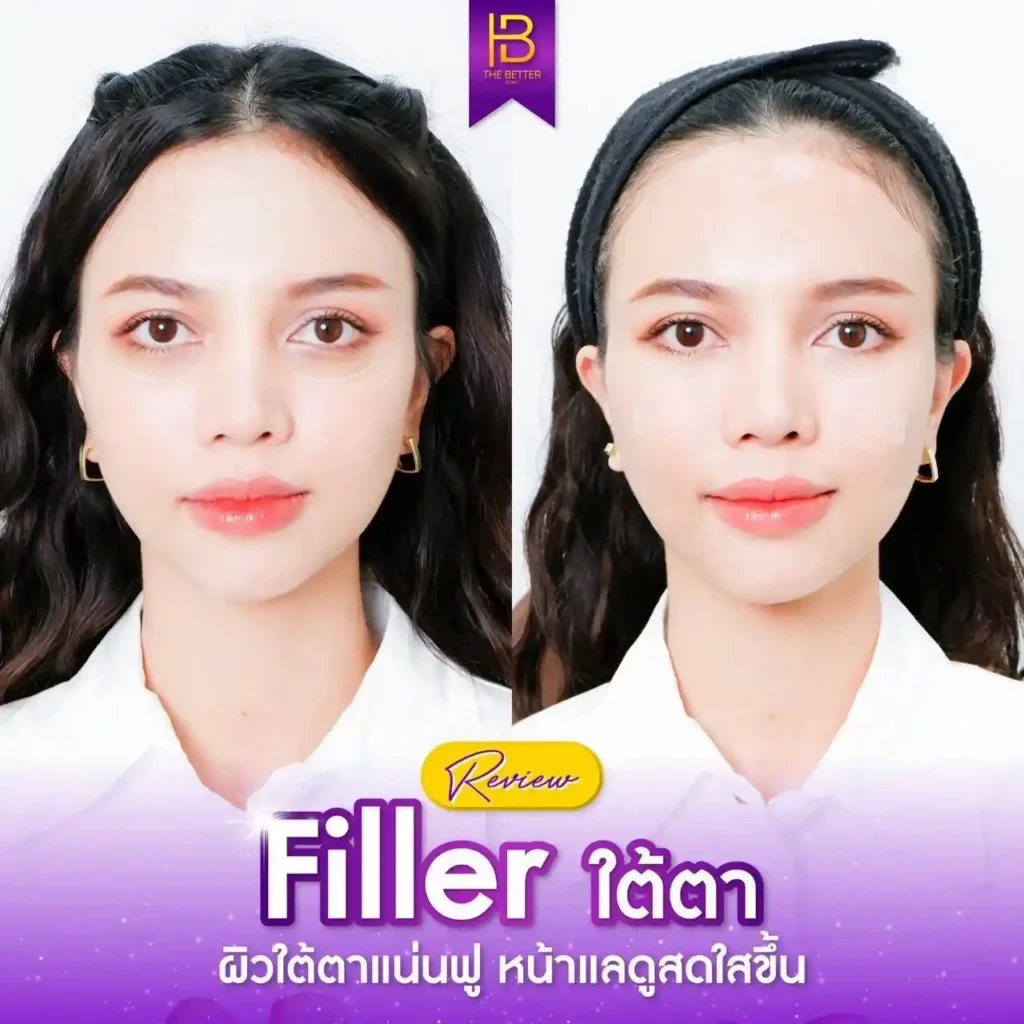 รูปรีวิว 130