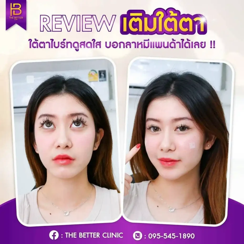 รูปรีวิว 135