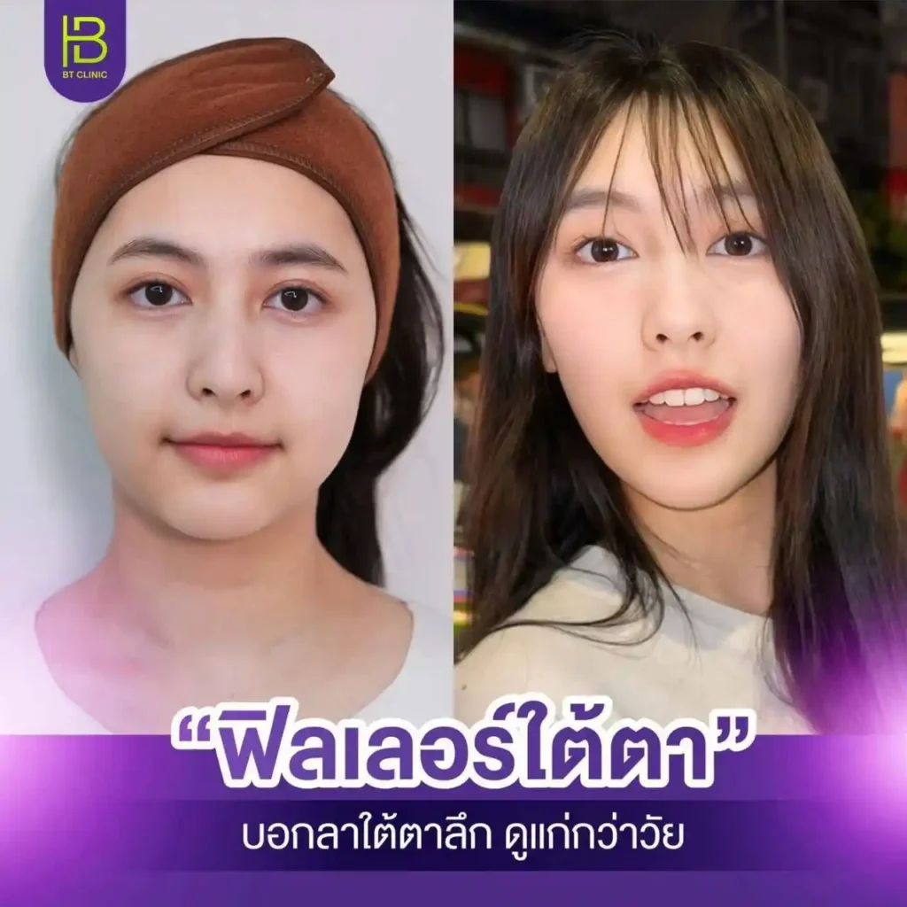รูปรีวิว 137