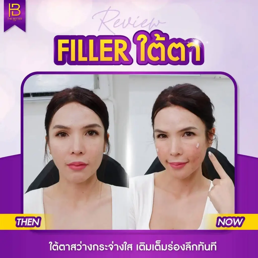 รูปรีวิว 140