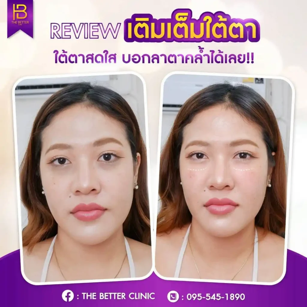 รูปรีวิว 141