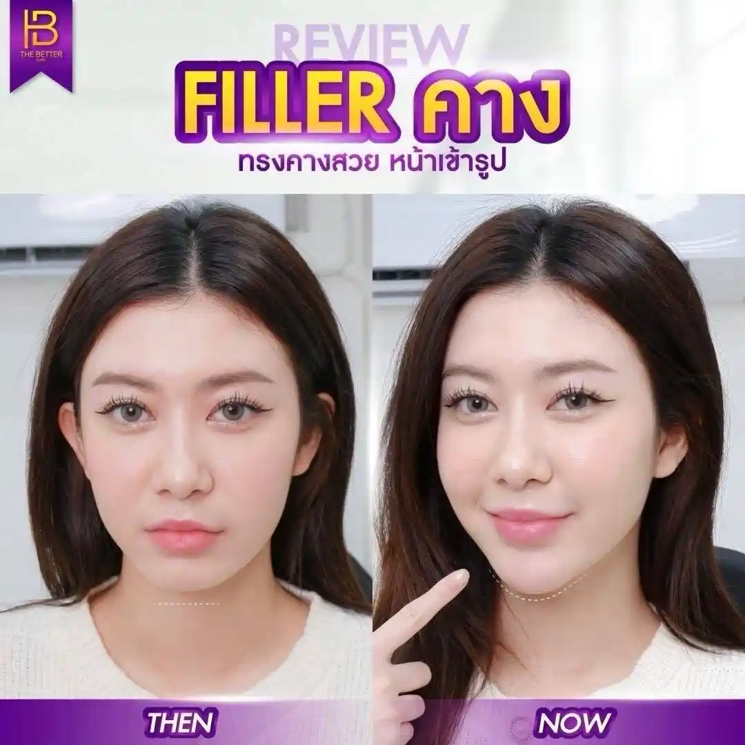 รูปรีวิว 145