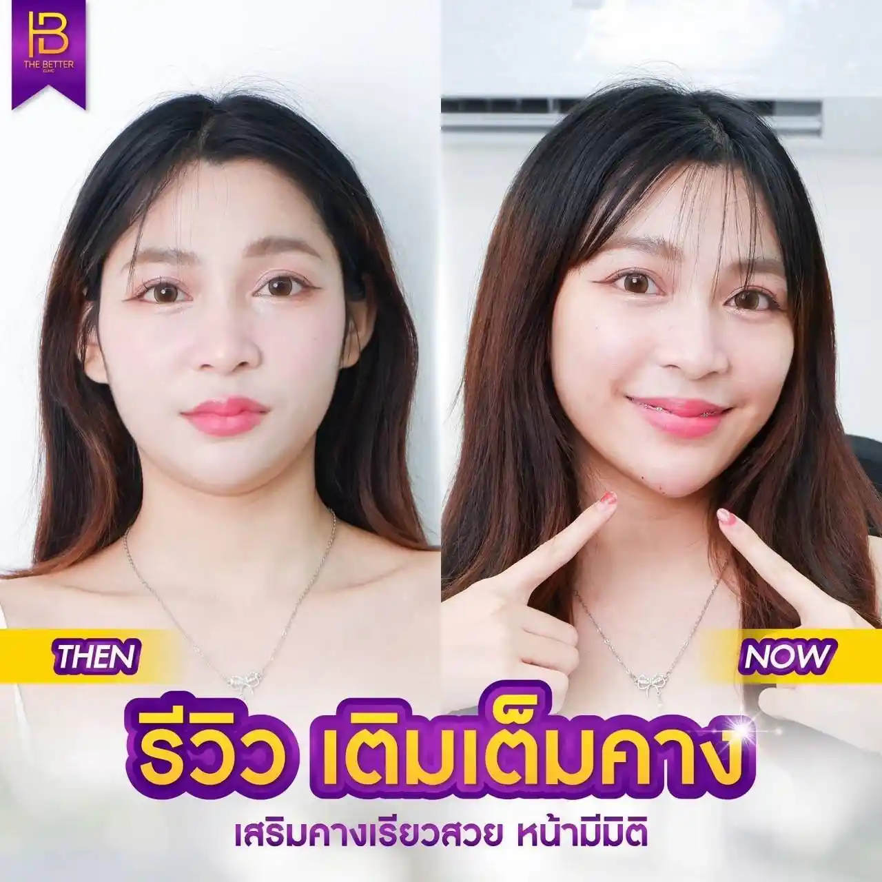 รูปรีวิว 147