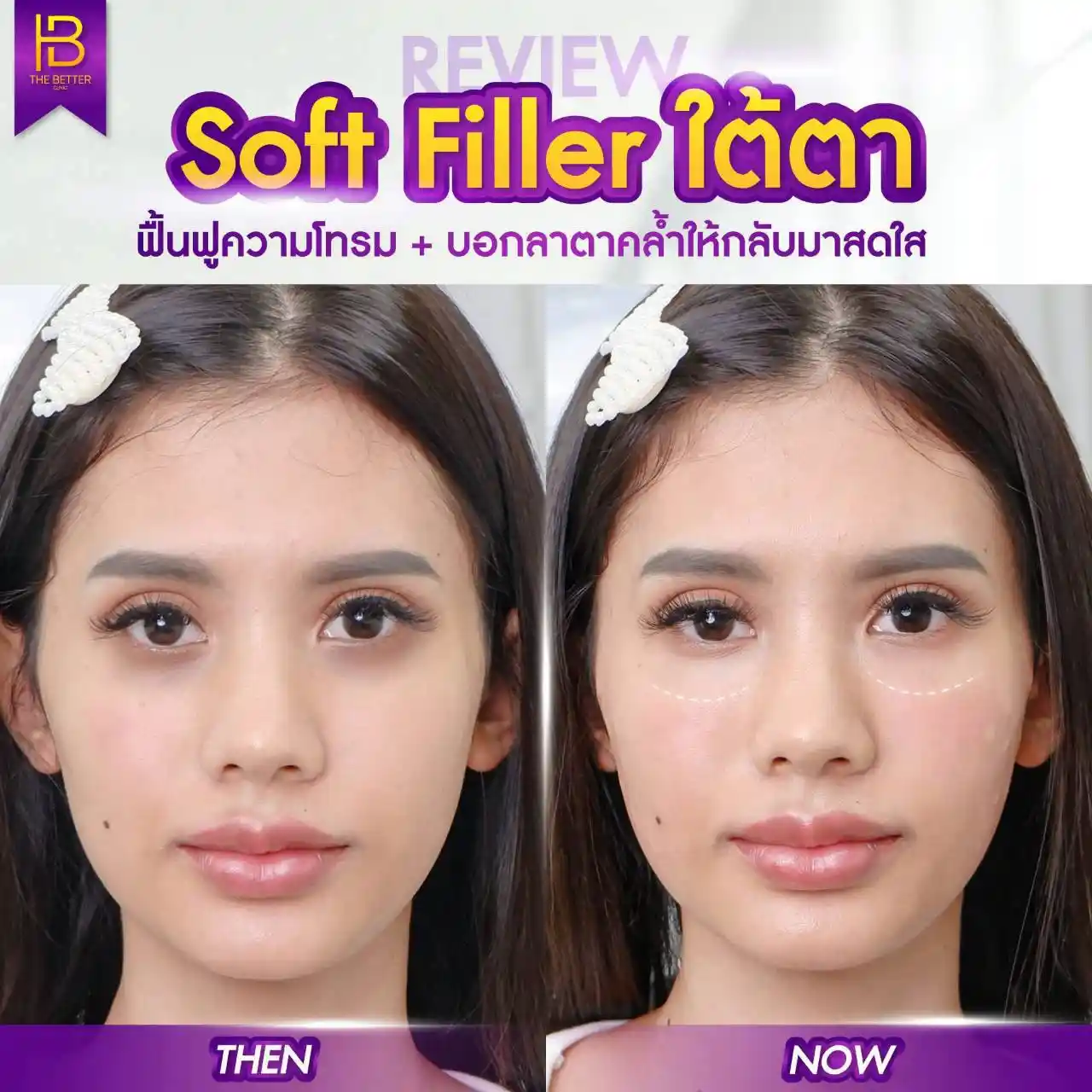 รูปรีวิว 149