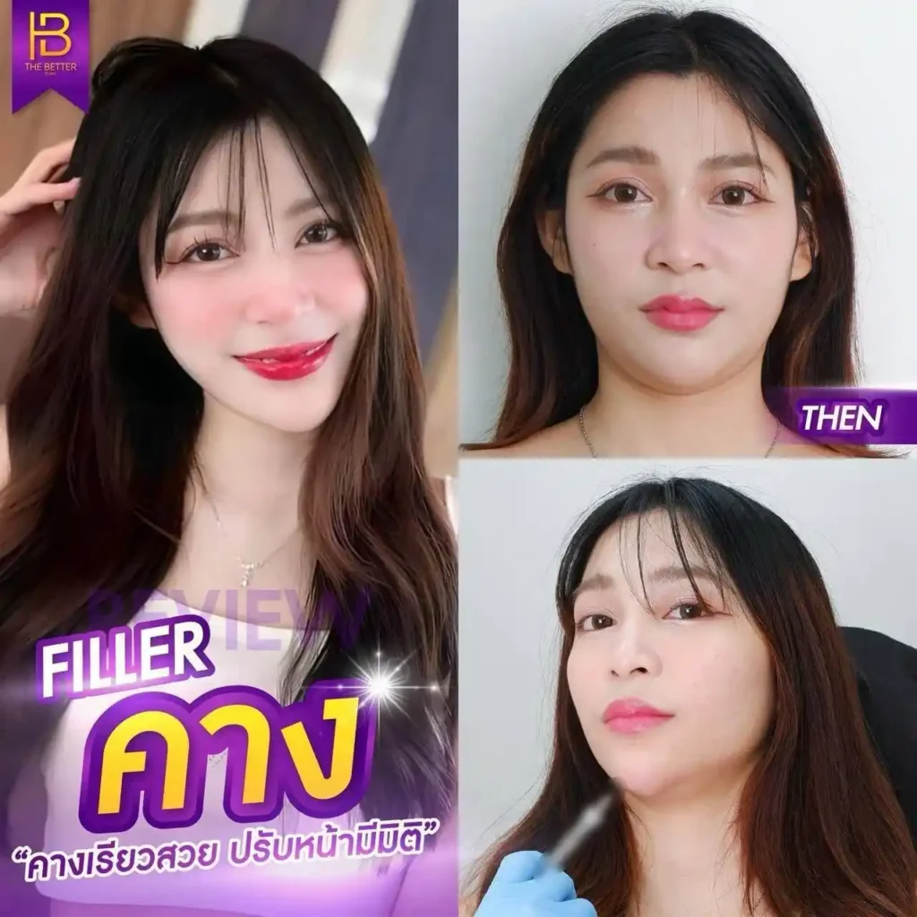 รูปรีวิว 151