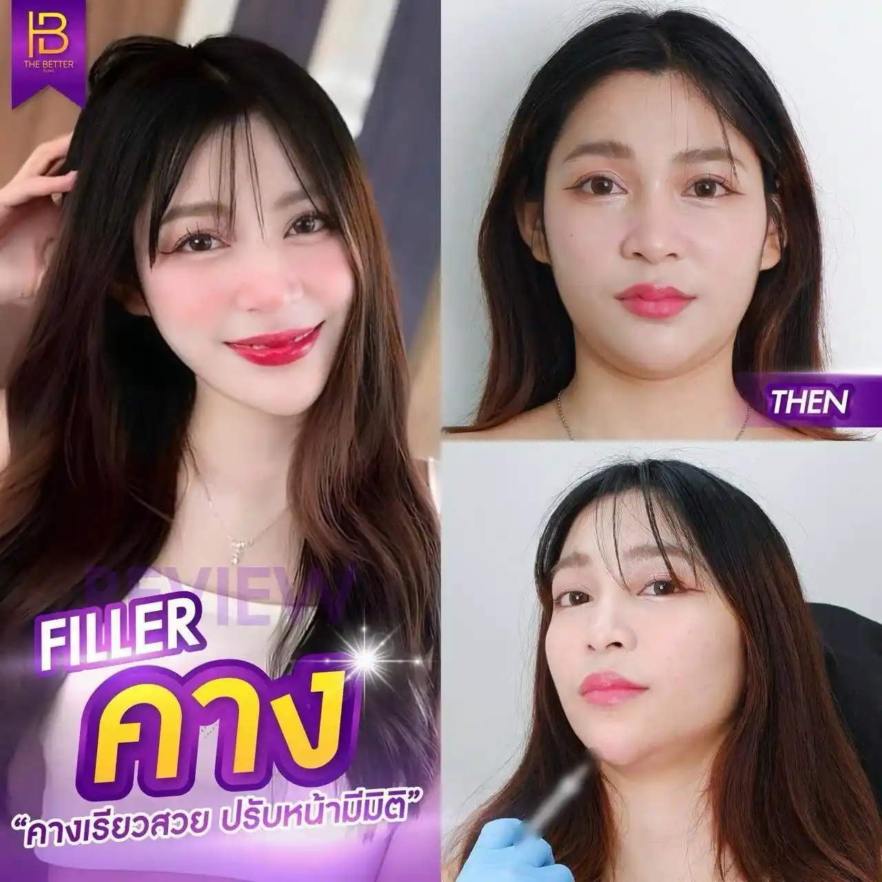 รูปรีวิว 151