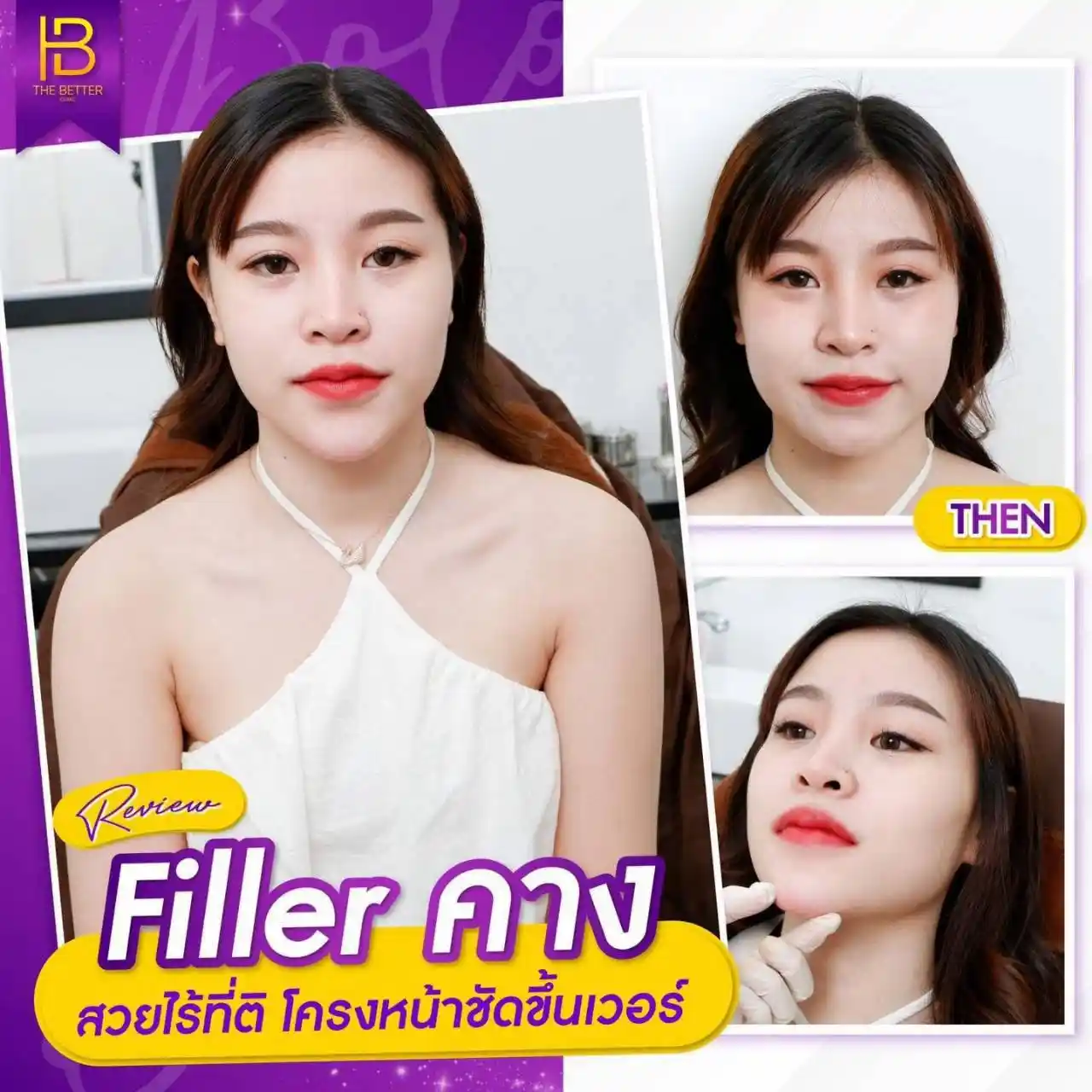 รูปรีวิว 153