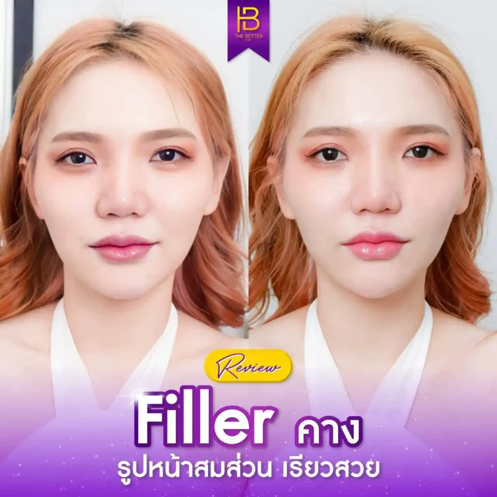 รูปรีวิว 154