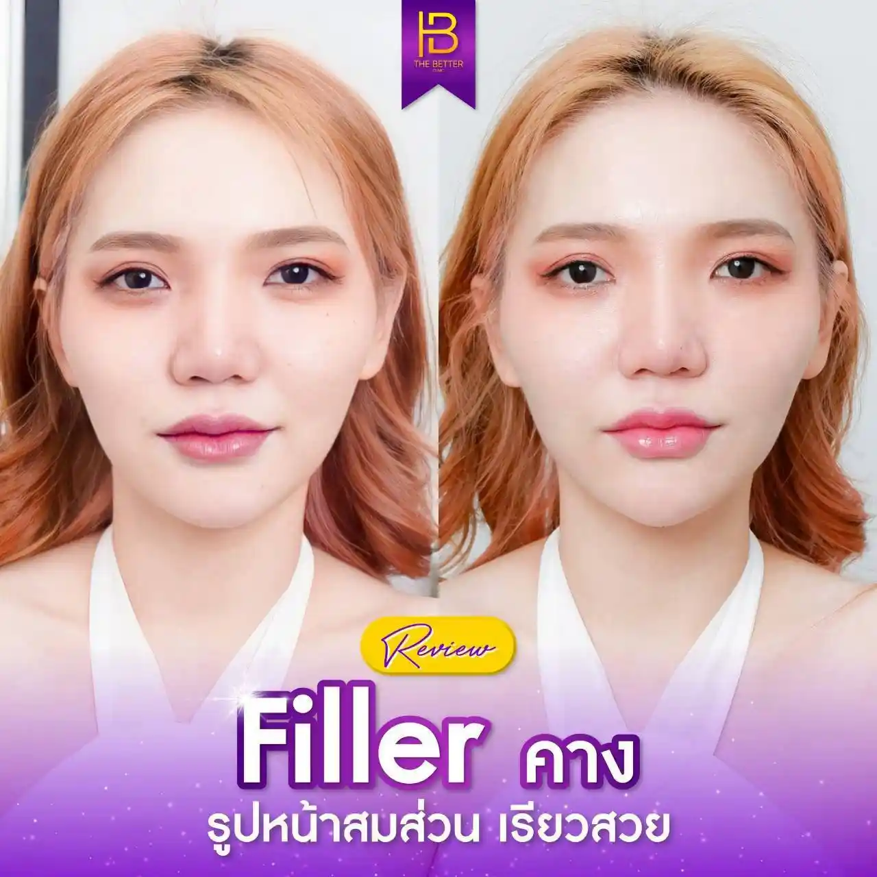 รูปรีวิว 154