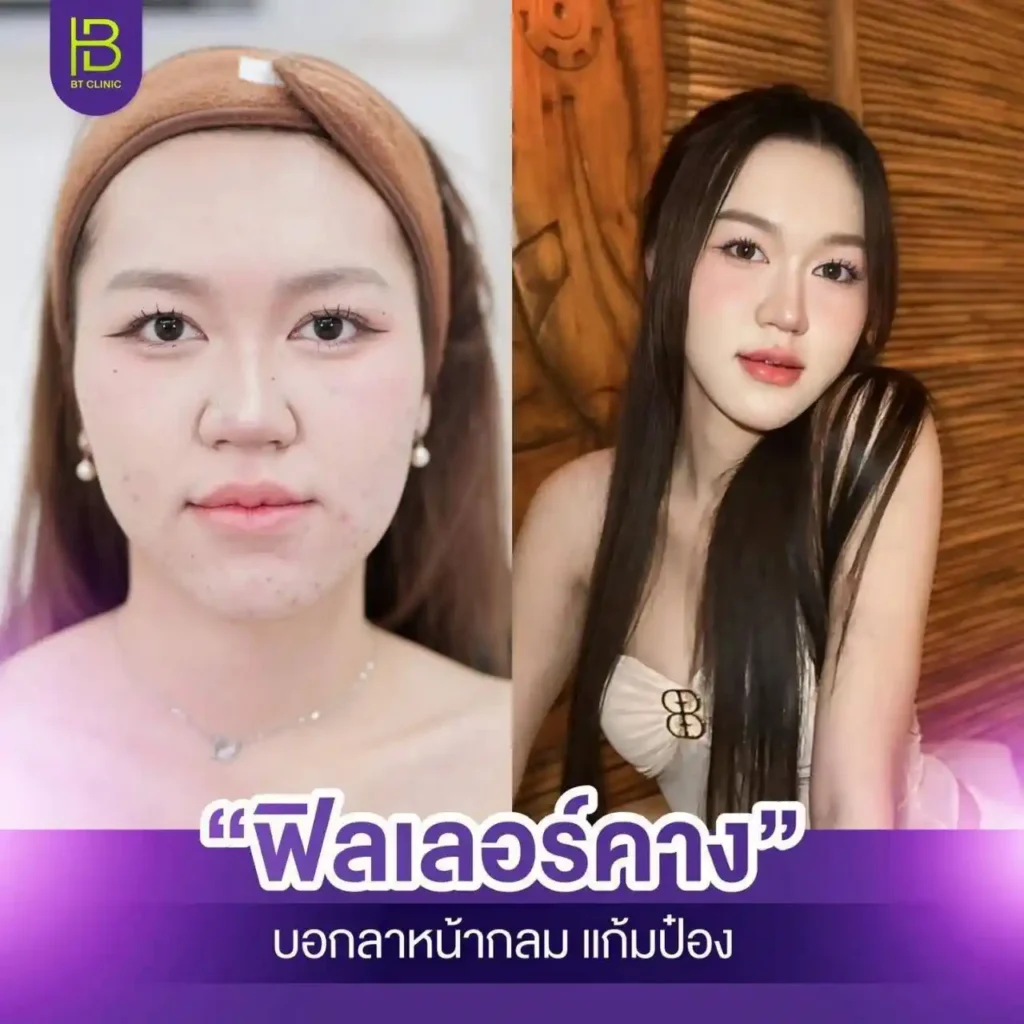 รูปรีวิว 155