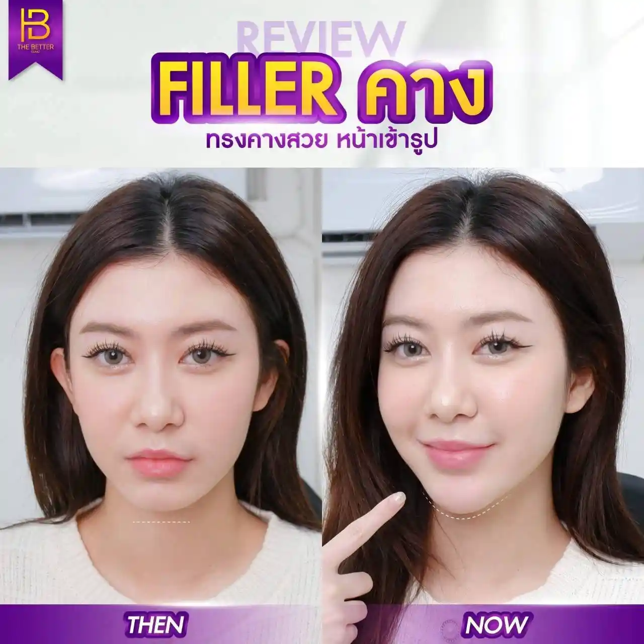 รูปรีวิว 156