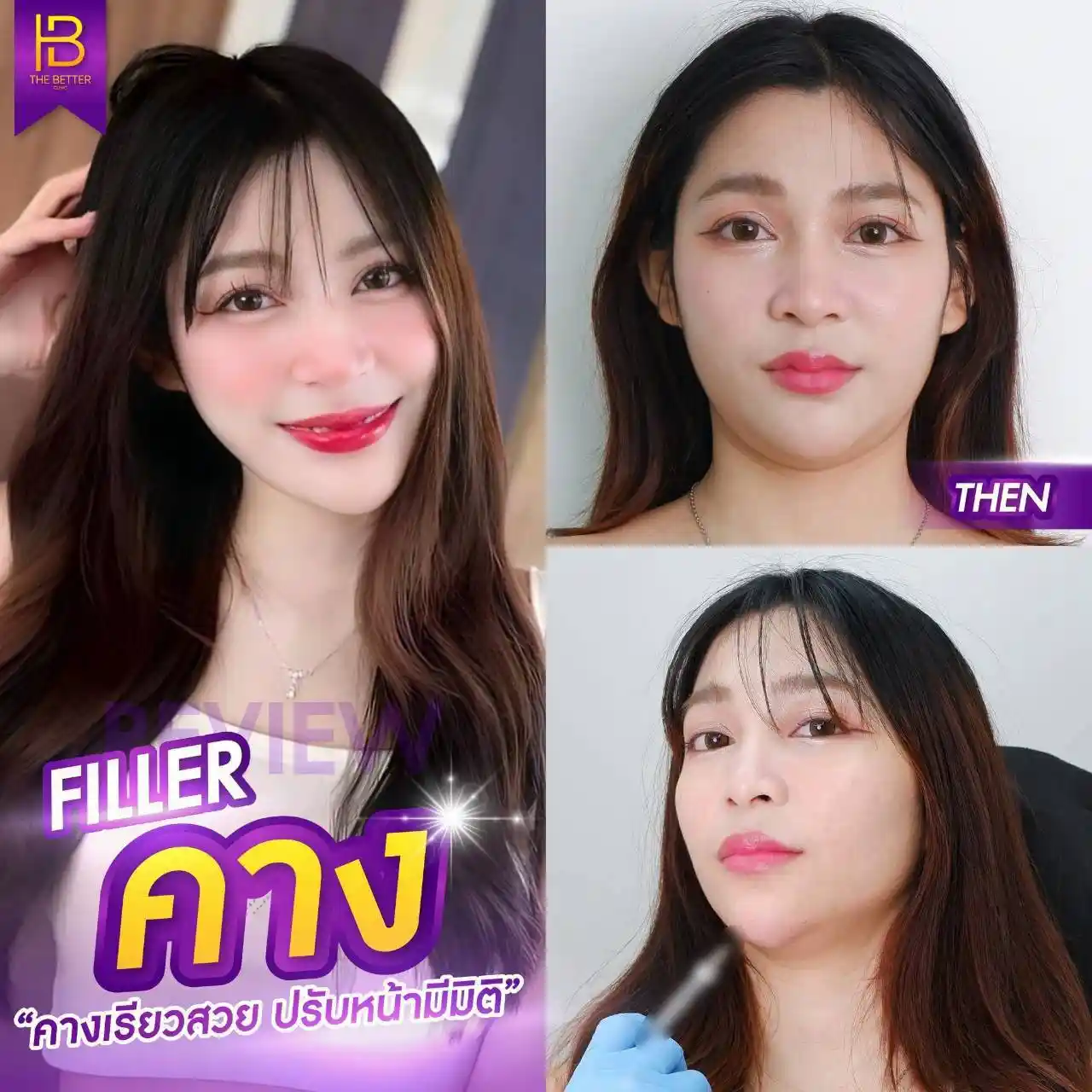 รูปรีวิว 157