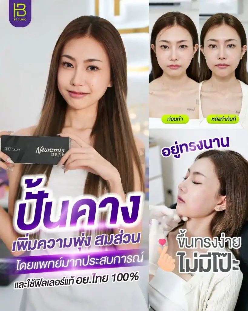 รูปรีวิว 158