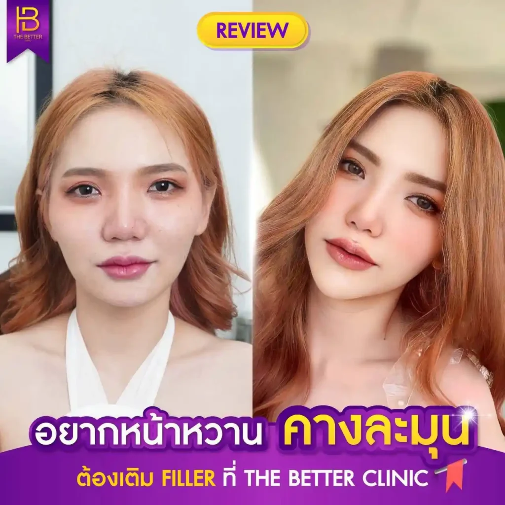 รูปรีวิว 160