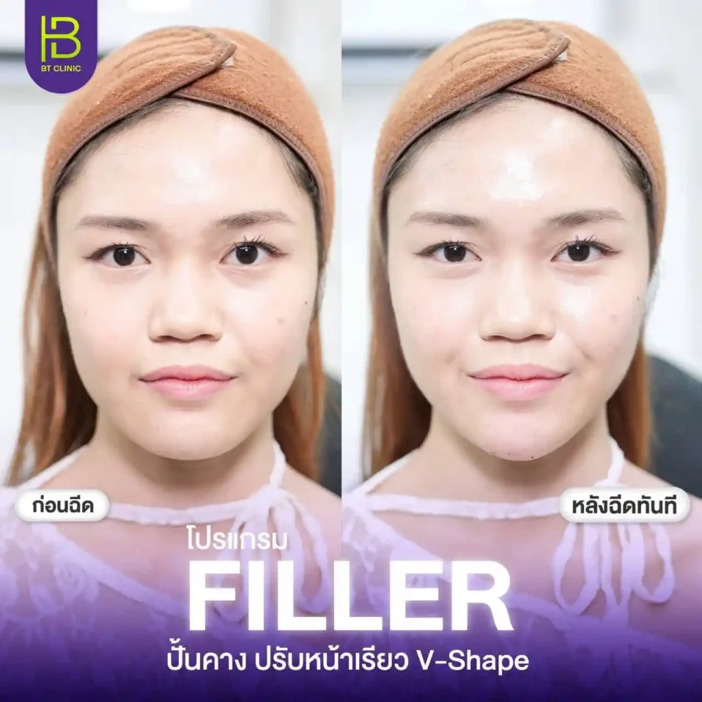 รูปรีวิว 163