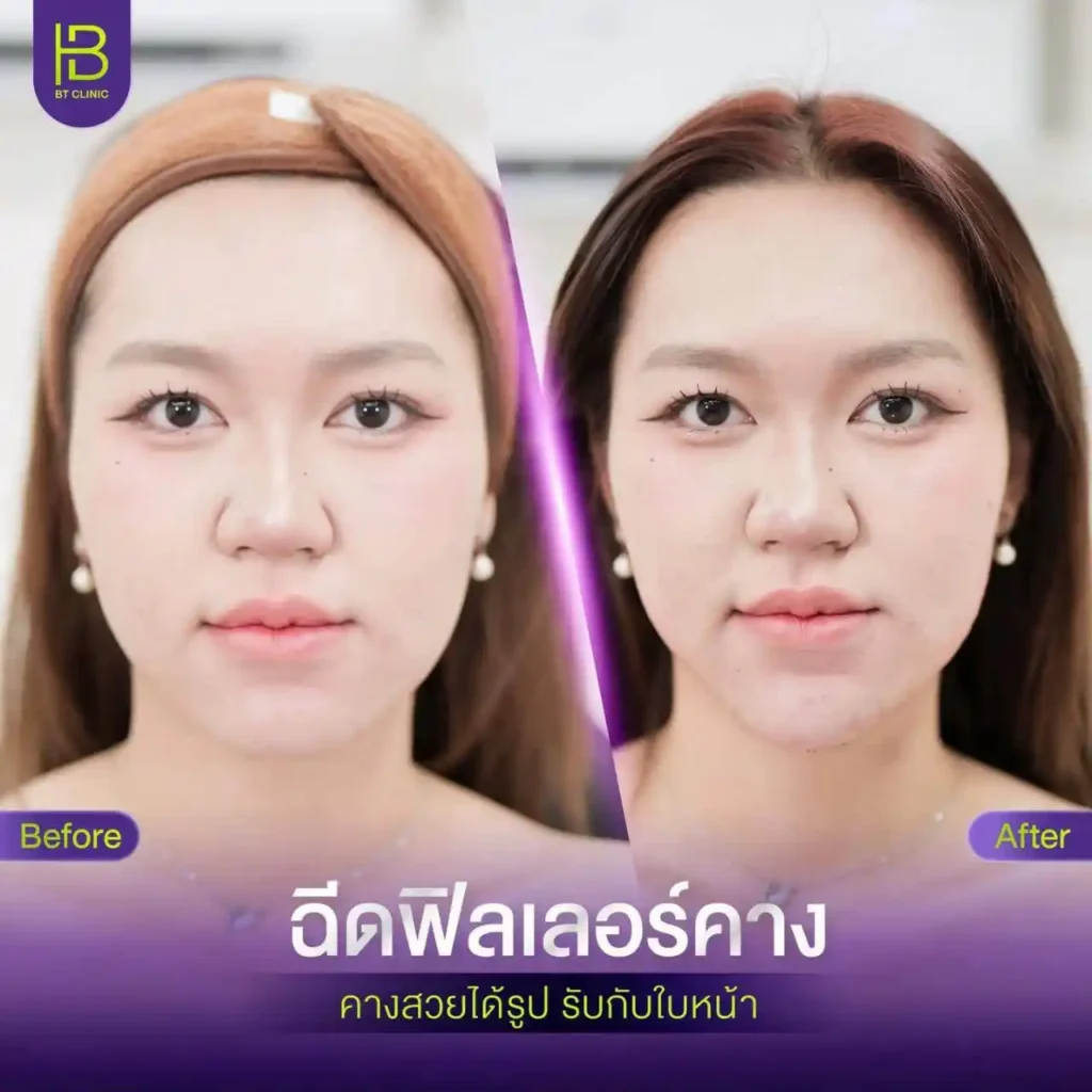 รูปรีวิว 164