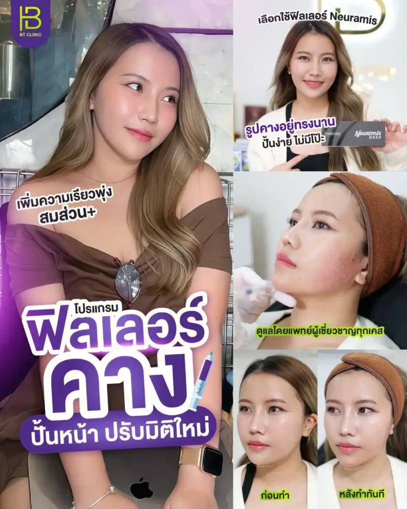 รูปรีวิว 165