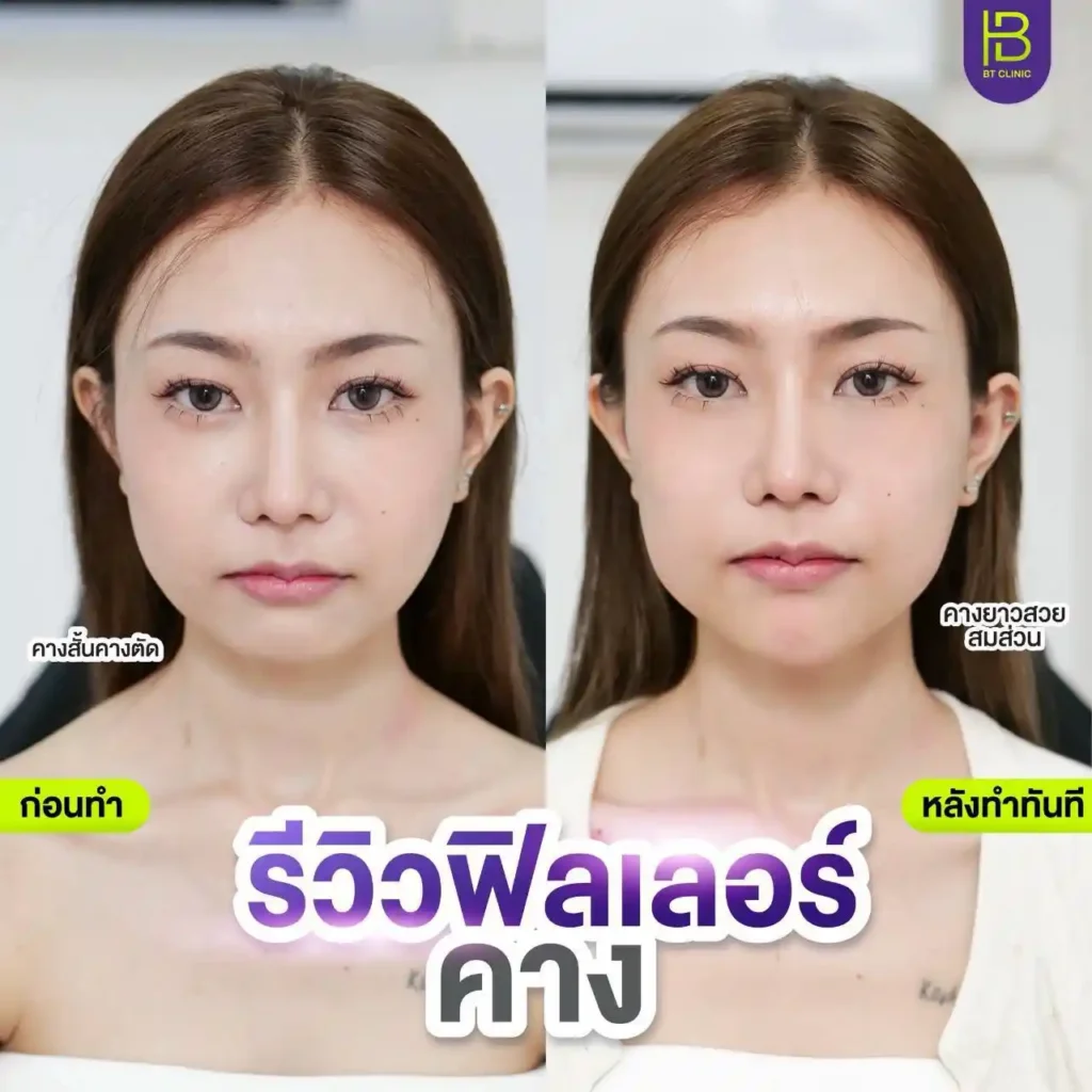 รูปรีวิว 167