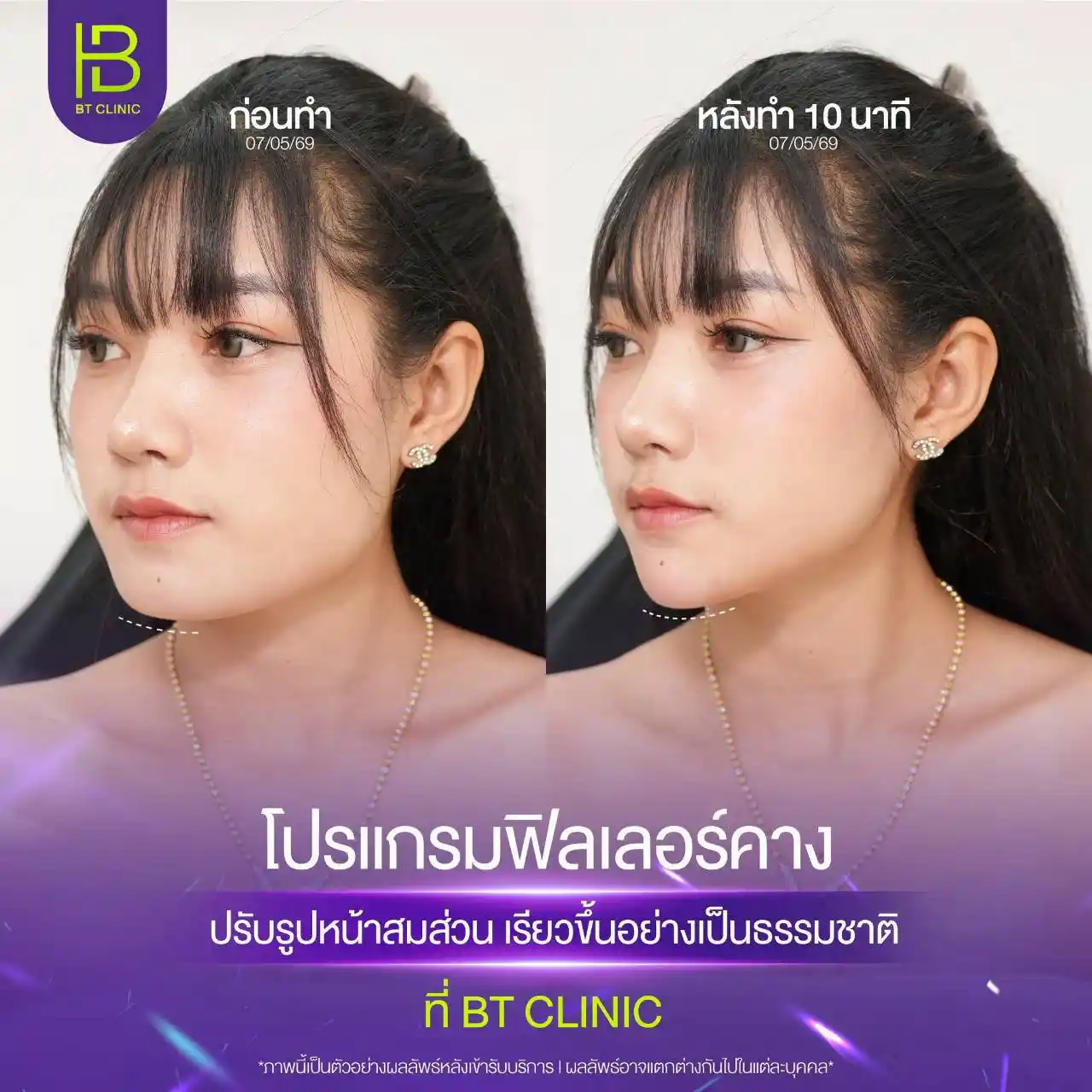 รูปรีวิว 168