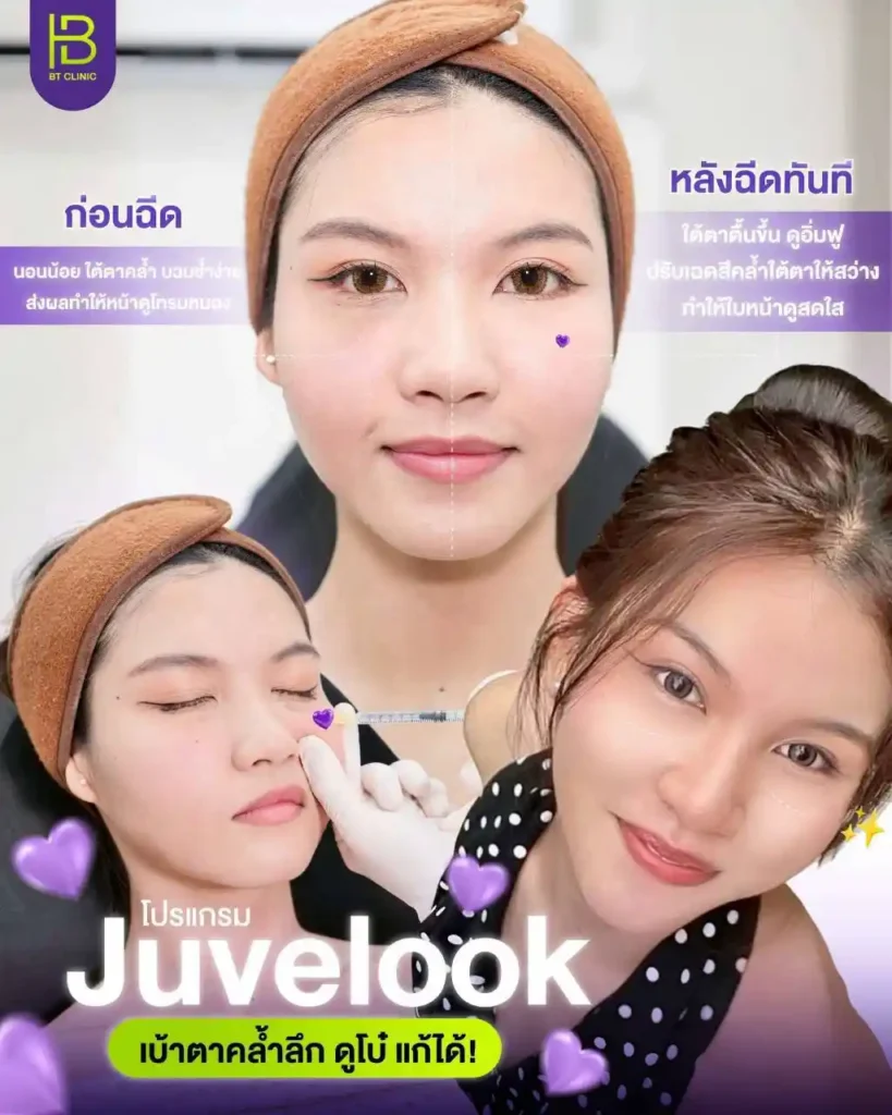 รูปรีวิว 169