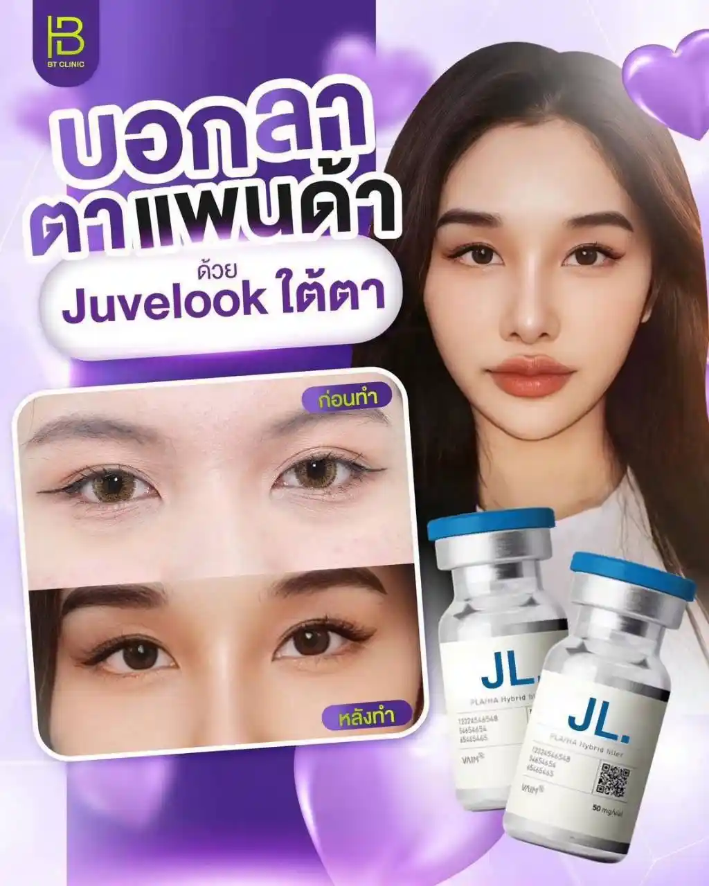 รูปรีวิว 171