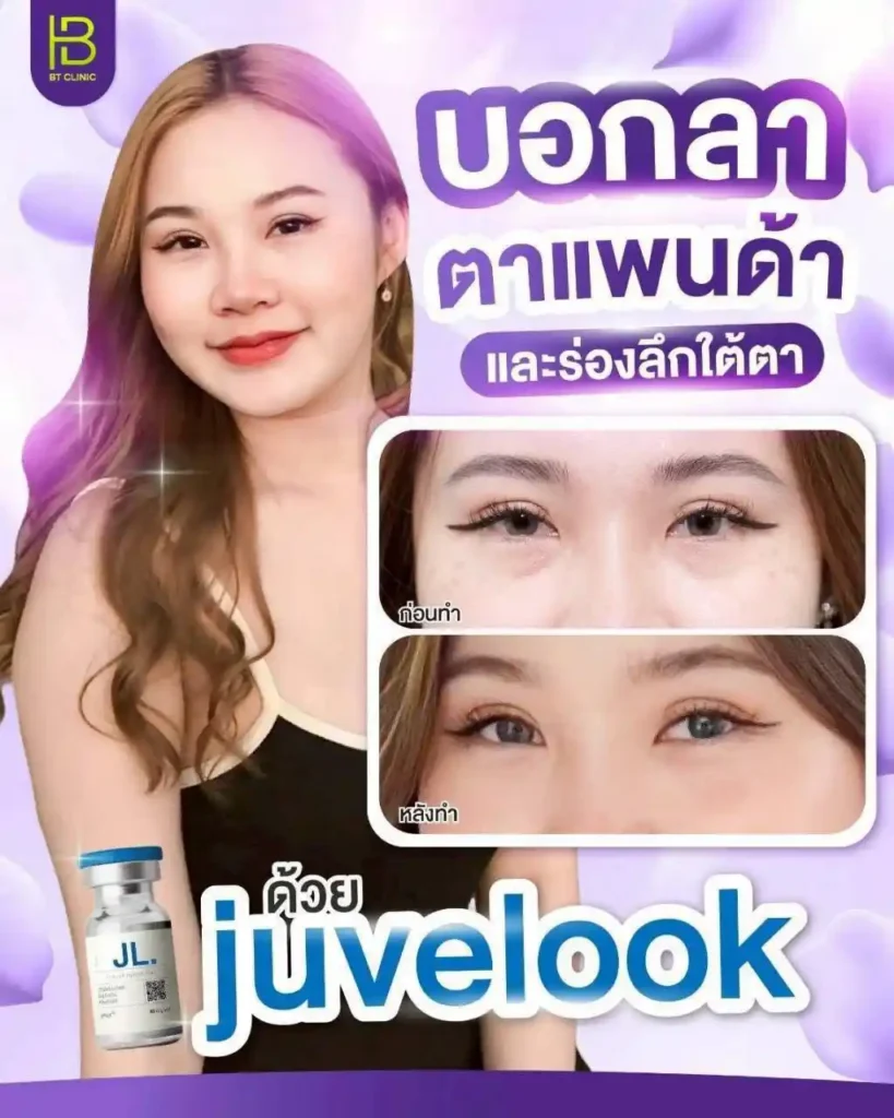 รูปรีวิว 172