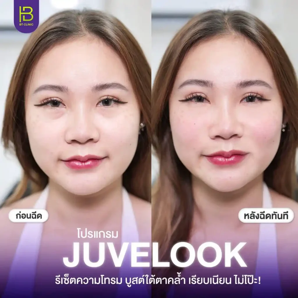 รูปรีวิว 175