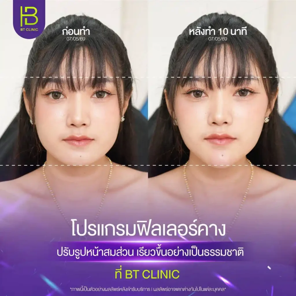 รูปรีวิว 176