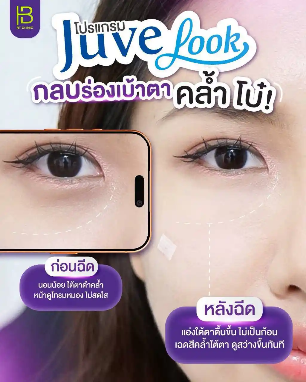 รูปรีวิว 179