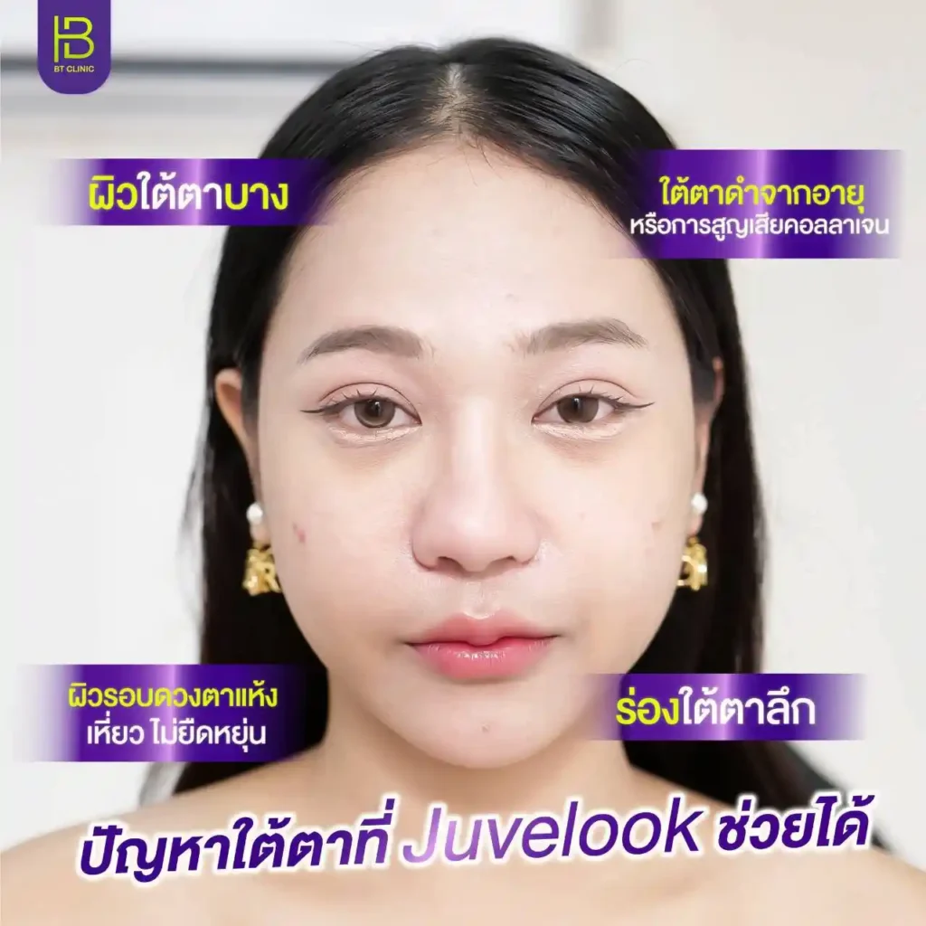 รูปรีวิว 180