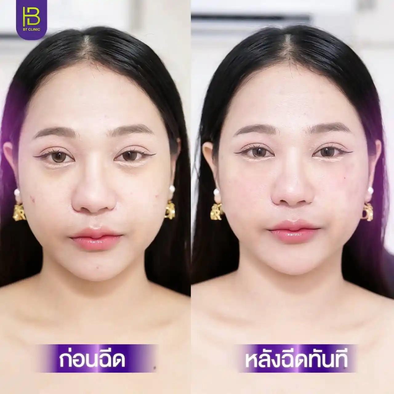 รูปรีวิว 181